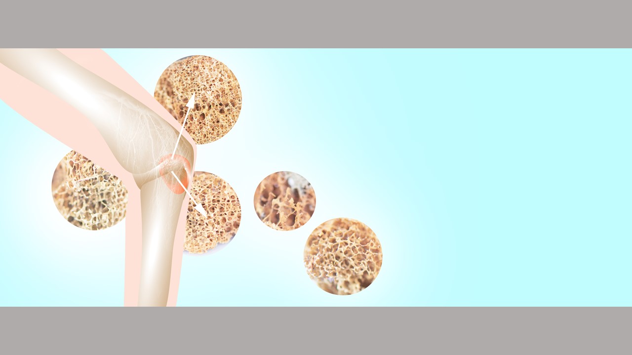 knee riddled with osteoporosis