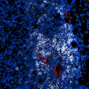 A fluorescence image of a tertiary lymphoid structure (TLS)