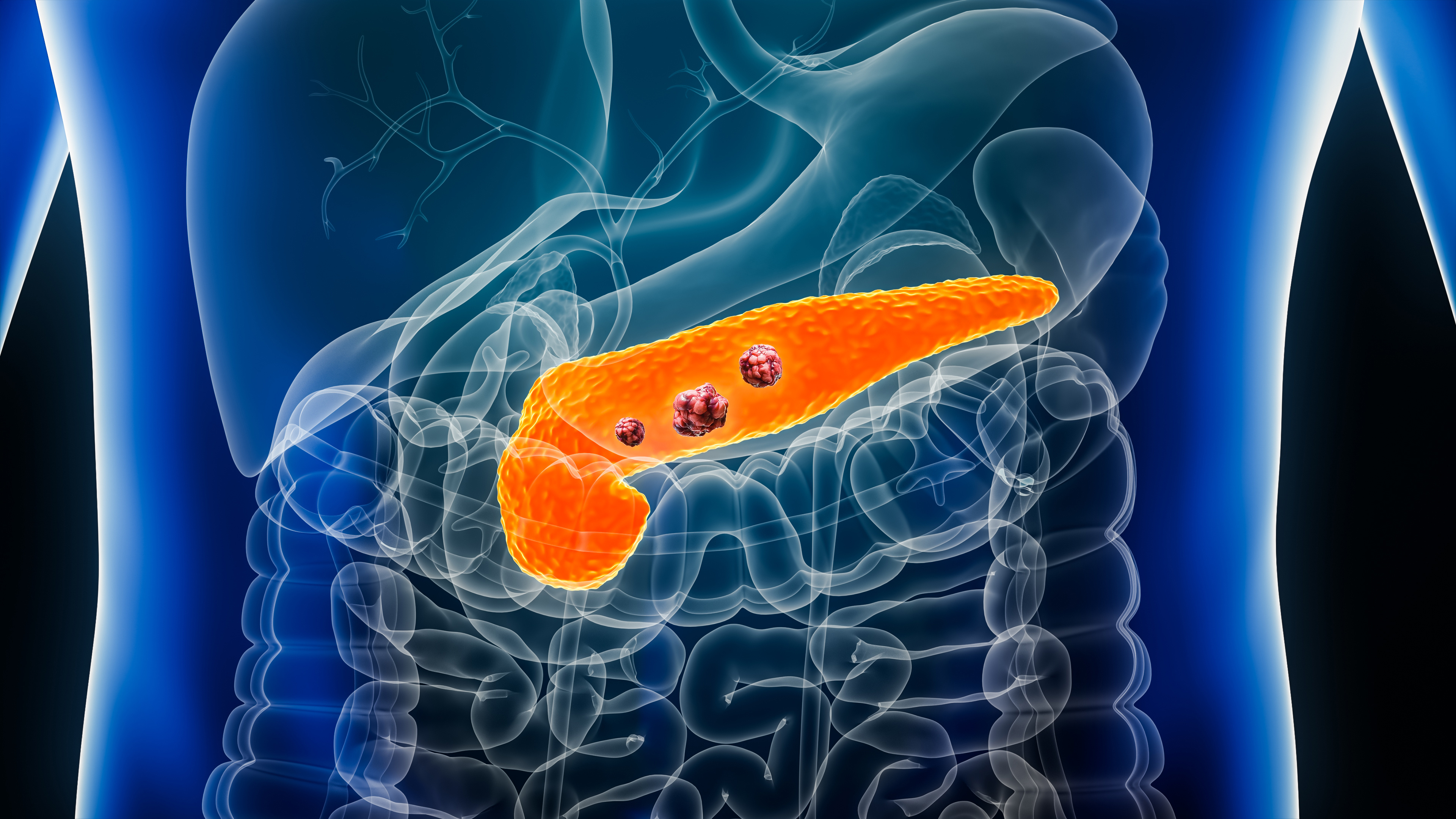 chromosome 1q