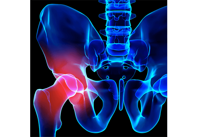 3D illustration of hip pain
