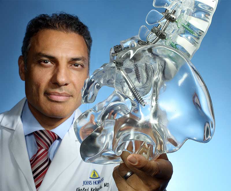 Khaled Kebaish holding a spine model