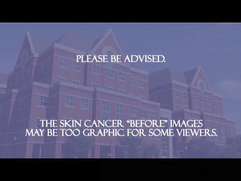 Skin cancer image warning