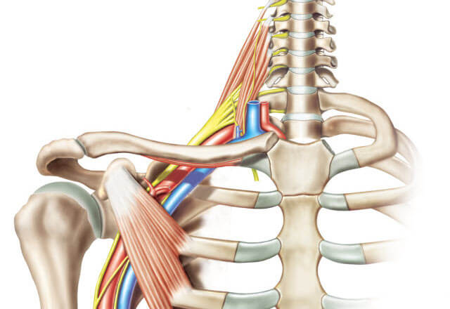 diagram of brachial plexus injuries