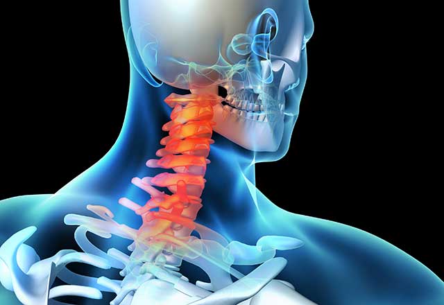 3D illustration showing a spinal injury