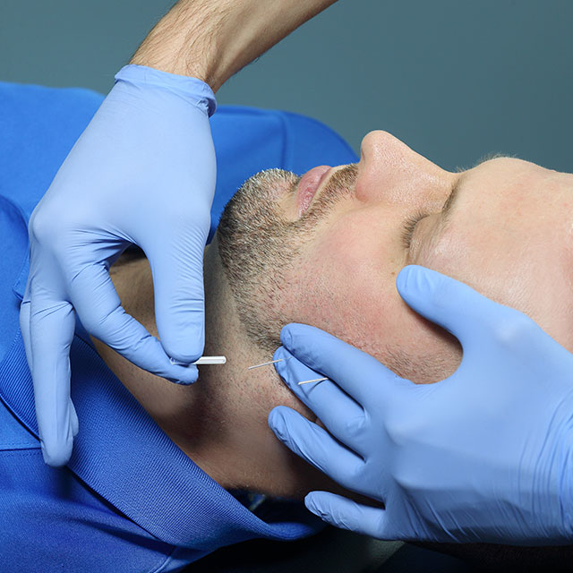 Dry Needling Featured Slide 8