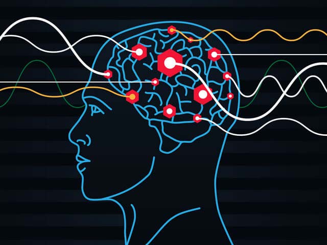 Brain scan graphic