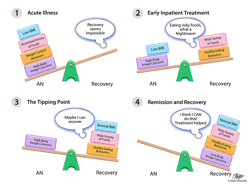 illustration for four stages of treament for anorexia