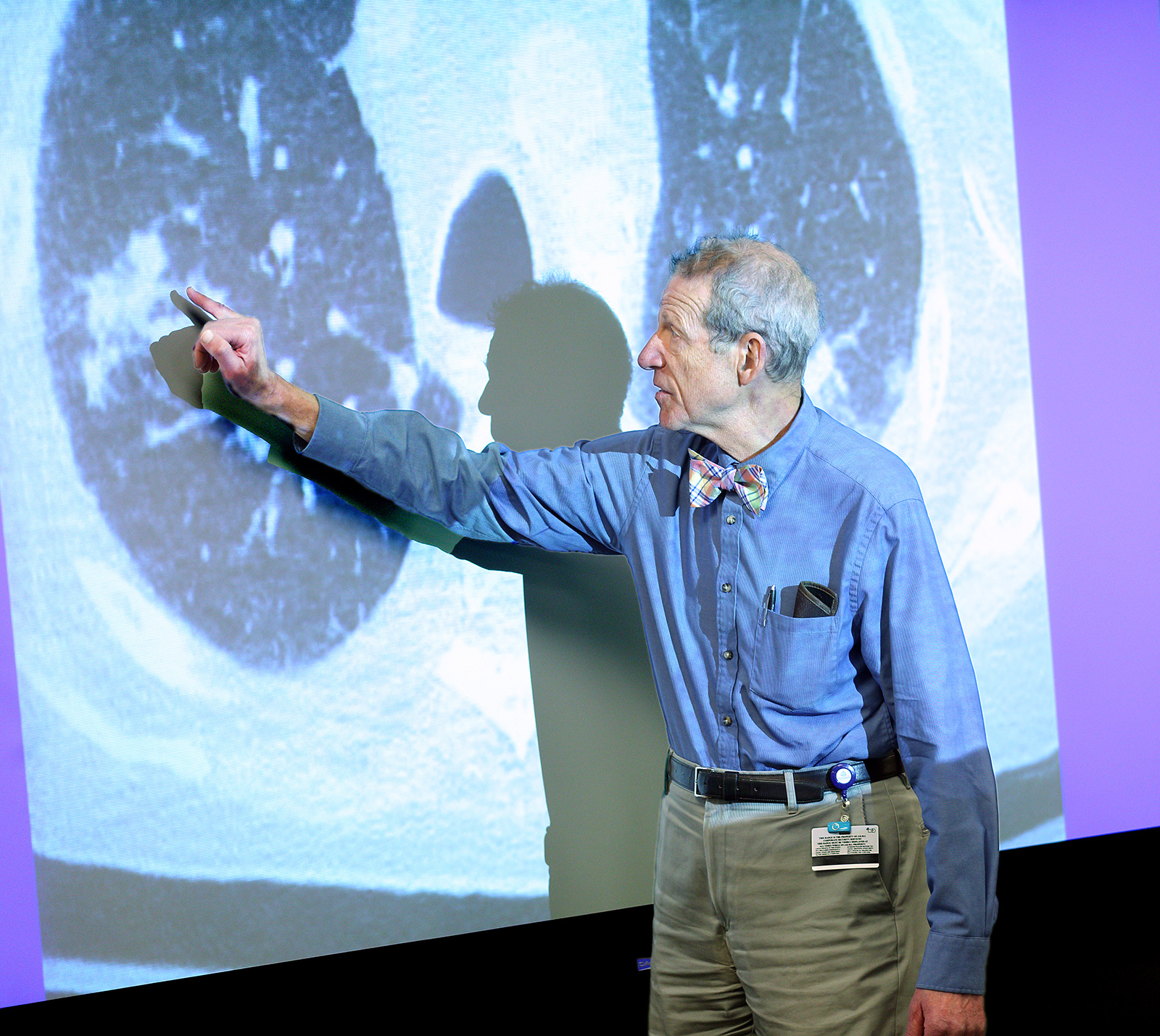Physician pointing at lungs radiograph