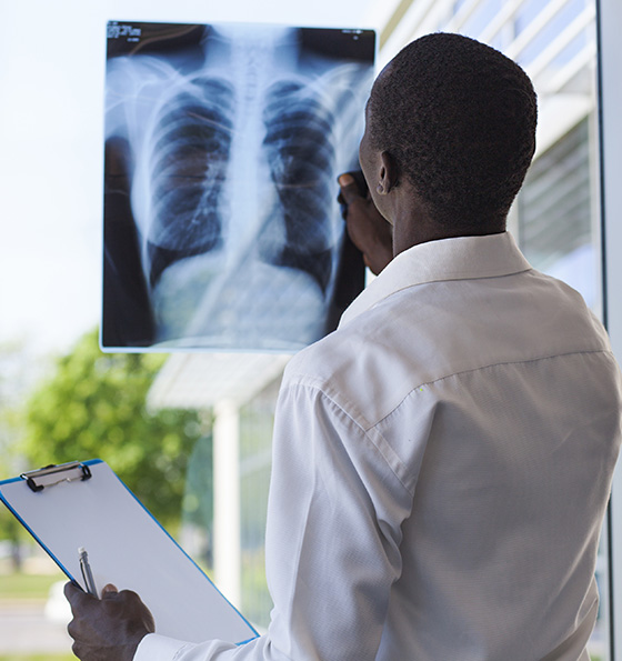 Lung Transplant Research
