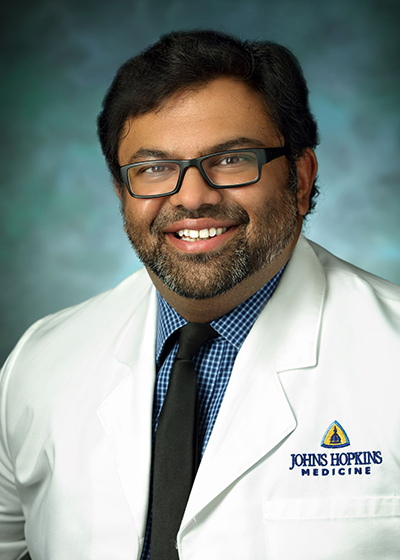  vivek YEDAVALLI