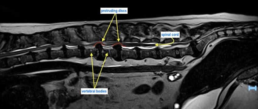 Lumbar Lesions images