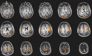 image of a BOLD fMRI
