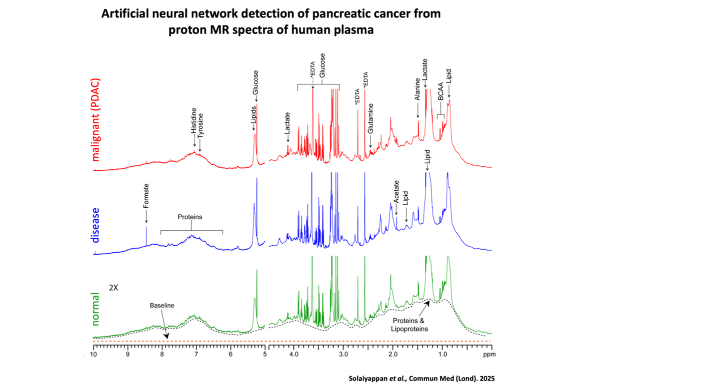 pancreatic cancer neural network