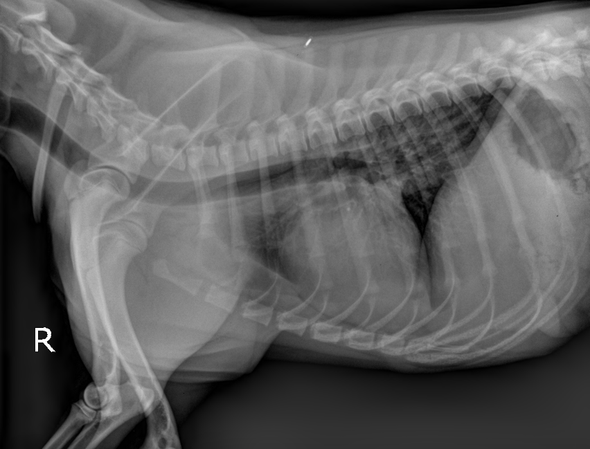 Lateral Radiograph of a Thorax
