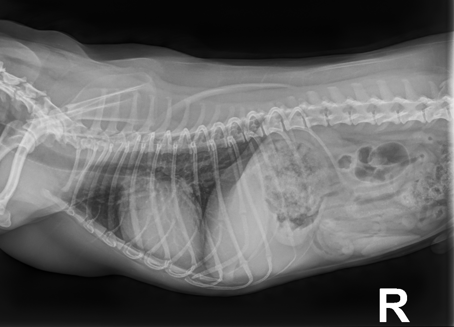 Lateral Radiograph of a Thorax