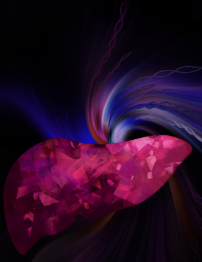 Cirrhosis of the liver