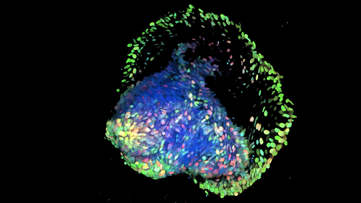 intestinal organoid 2