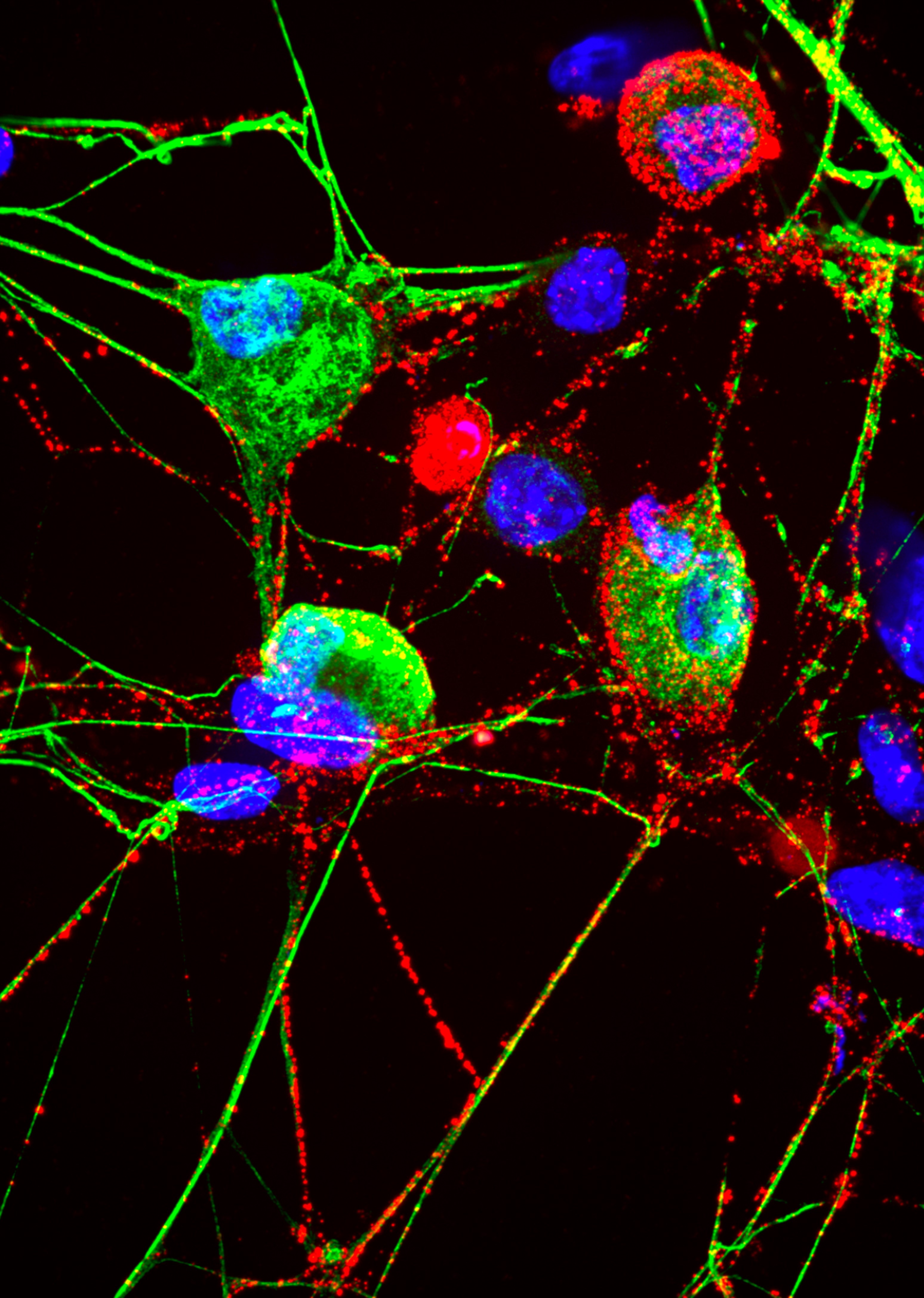 Neuronal membrane proteasomes are labeled with a red compound and appear in a subset of sensory neurons that are labeled with green compound. Note, not all green labeled neurons have the red label, which can appear in other unique dorsal root ganglion neurons that do not label with green. Blue staining is the nuclei of cells in the culture dish. Credit: Seth Margolis and Eric Villalón Landeros, Johns Hopkins Medicine.
