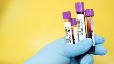 blood collection tubes