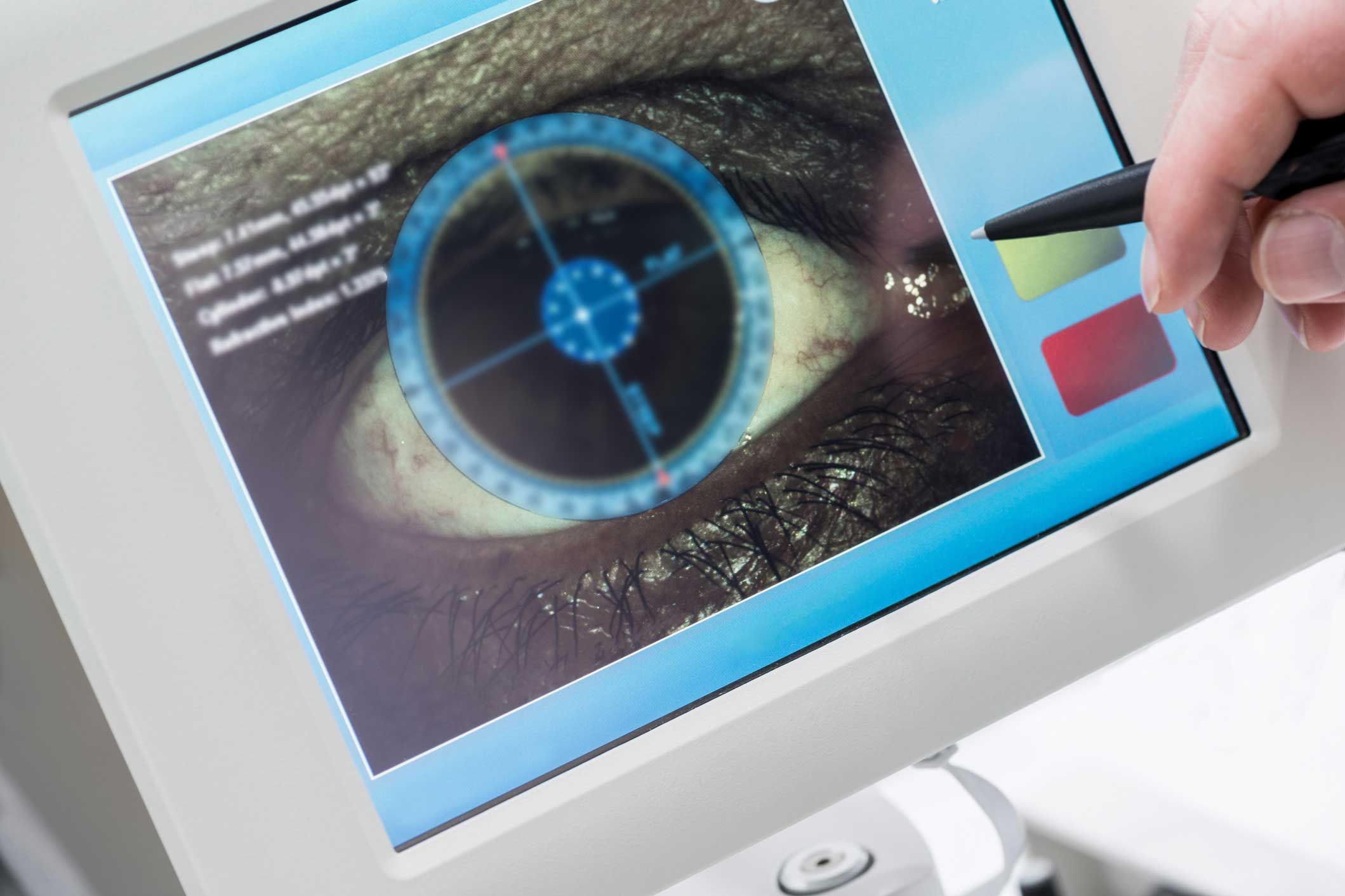 Optometrist checks patient's eye with retinoscope