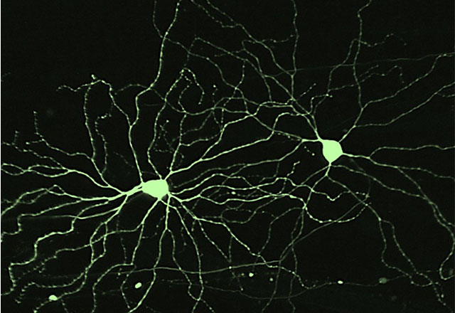 Glaucoma Pathophysiology and Neuroprotection from The Johnson Lab