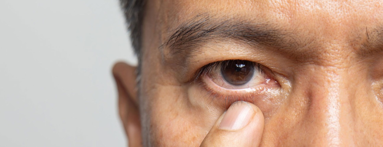 A man tugs his lower left eyelid. 