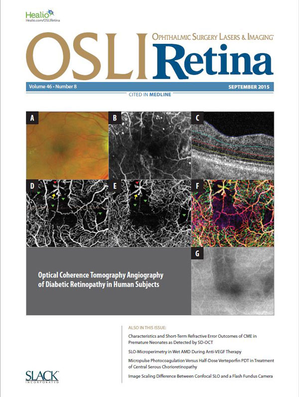 Kashani lab research featured on the cover of Ophthalmic Surgery Lasers and Imaging Retina Sept 2015 Featured Slide 2
