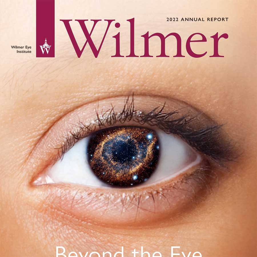Annual report 2022 cover showing an eye up close with a galaxy reflected in the iris.