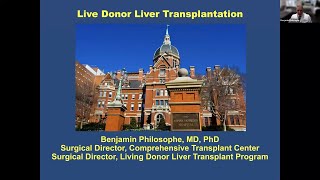 Benefits of Living Liver Donation Webinar