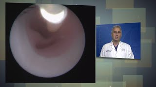 Fetoscopic Tracheal Occlusion Procedure for Congenital Diaphragmatic Hernia CDH