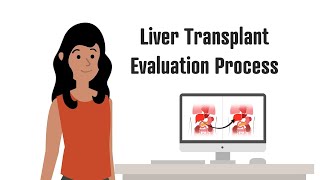 Liver Transplantation  The Evaluation Process