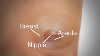 Mastectomy  Breast Reconstruction Overview