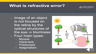 Refractive Error  A Patient Guide to Glasses