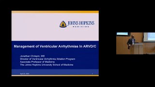 Role of Catheter Ablation in Arrhythmogenic Right Ventricular Cardiomyopathy ARVC