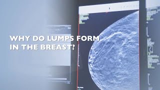 What To Do When You Find a Lump in Your Breast