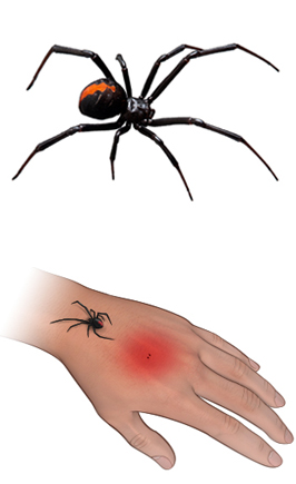 Spider Bites Johns Hopkins Medicine
