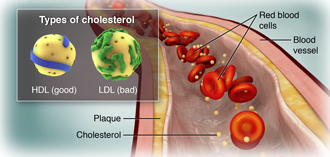 Cholesterin im Blutkreislauf