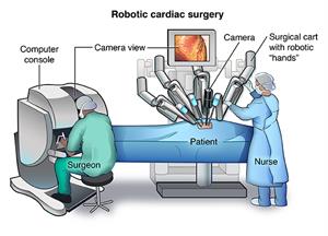Robotic Cardiac Surgery | Johns Hopkins