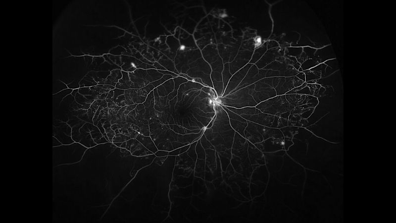 Blood vessels that feed the retina