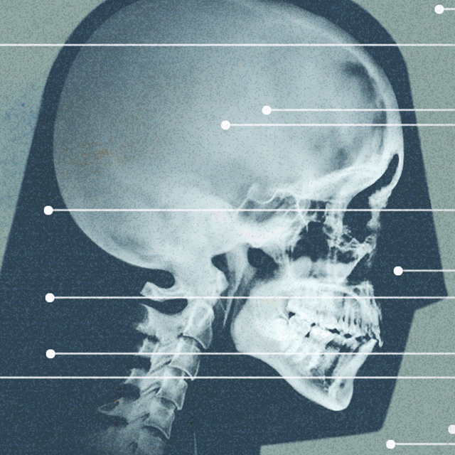 Bone and Facial Reconstruction