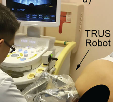 medical robotics in urology