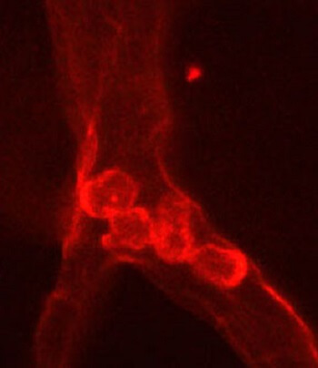Retinal blood vessels graphic