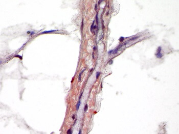 WISP-1
