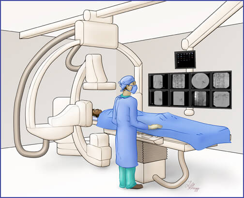 Illustration showineg the angiography suite with a patient on the table and a doctor looking at images on screens.