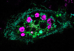 A healthy cell (green) that has recognized and engulfed dying cells (purple).