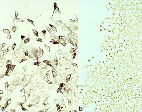 Immunohistochemical staining for PDGF and PDGF receptor in wounded RPE cultures.