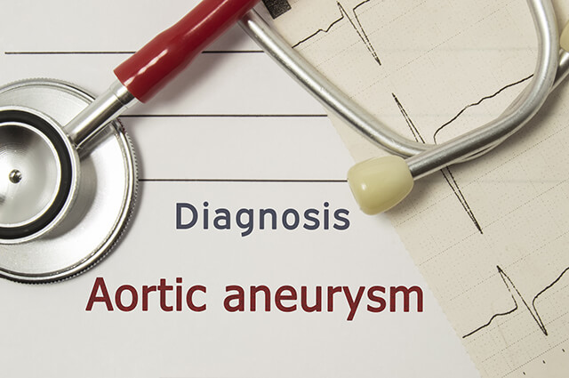 aortic aneurysm