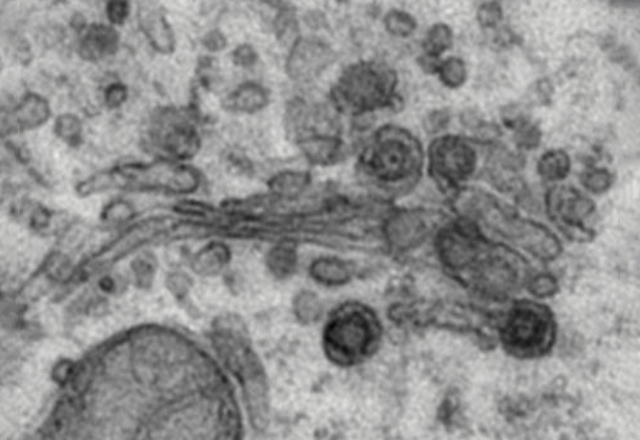 Thin section electron micrograph of a cell infected with the coronavirus infectious bronchitis virus showing virus particles assembling in a Golgi region.