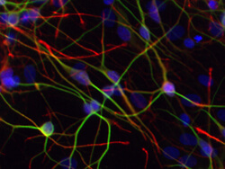 Human neurons differentiated from induced pluripotent stem cells, with cell nuclei shown in blue and synapses in red and green.