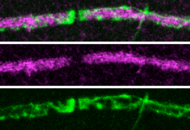 Research Update - Myelin Remodeling  Through Experience Dependent Oligodendrogenesis